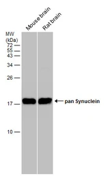 Anti-pan Synuclein antibody used in Western Blot (WB). GTX133368