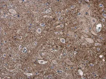 Anti-pan Synuclein antibody used in IHC (Paraffin sections) (IHC-P). GTX133368