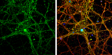 Anti-pan Synuclein antibody used in Immunocytochemistry/ Immunofluorescence (ICC/IF). GTX133368