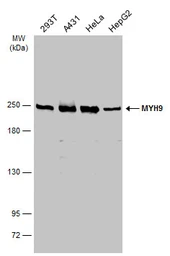 Anti-MYH9 antibody used in Western Blot (WB). GTX133377