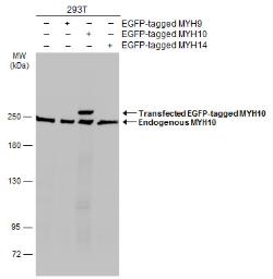 Anti-MYH10 antibody used in Western Blot (WB). GTX133378