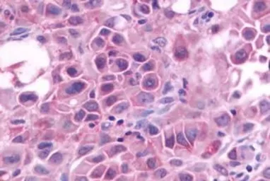 Anti-GRPR antibody used in IHC (Paraffin sections) (IHC-P). GTX13339