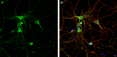 Anti-nNOS antibody used in Immunocytochemistry/ Immunofluorescence (ICC/IF). GTX133403