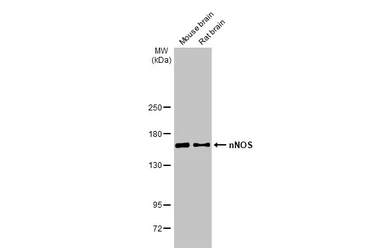 Anti-nNOS antibody used in Western Blot (WB). GTX133403