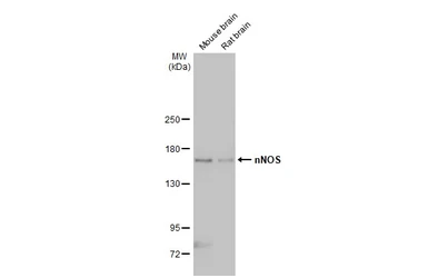 Anti-nNOS antibody used in Western Blot (WB). GTX133407