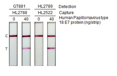 Human Papillomavirus type 18 E7 protein, His tag. GTX133412-pro