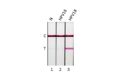 Human Papillomavirus type 18 E7 protein, His tag. GTX133412-pro