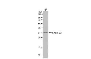 Anti-Cyclin D2 antibody used in Western Blot (WB). GTX133418