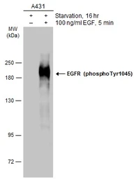 Anti-EGFR (phospho Tyr1045) antibody used in Western Blot (WB). GTX133431