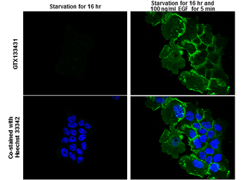 Anti-EGFR (phospho Tyr1045) antibody used in Immunocytochemistry/ Immunofluorescence (ICC/IF). GTX133431
