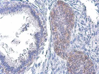 Anti-EGFR (phospho Tyr1045) antibody used in IHC (Paraffin sections) (IHC-P). GTX133431