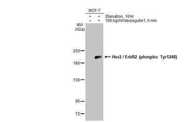 Anti-Her2 / ErbB2 (phospho Tyr1248) antibody used in Western Blot (WB). GTX133439