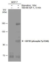 Anti-IGF1R beta (phospho Tyr1316) antibody used in Western Blot (WB). GTX133448