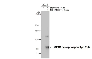 Anti-IGF1R beta (phospho Tyr1316) antibody used in Western Blot (WB). GTX133448