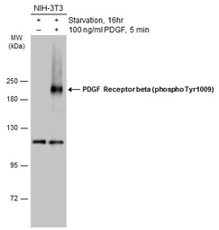 Anti-PDGF Receptor beta (phospho Tyr1009) antibody used in Western Blot (WB). GTX133453