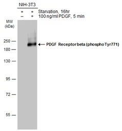 Anti-PDGF Receptor beta (phospho Tyr771) antibody used in Western Blot (WB). GTX133456