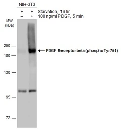 Anti-PDGF Receptor beta (phospho Tyr751) antibody used in Western Blot (WB). GTX133457