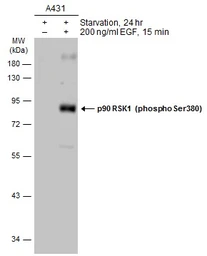 Anti-p90 RSK1 (phospho Ser380) antibody used in Western Blot (WB). GTX133467