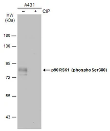 Anti-p90 RSK1 (phospho Ser380) antibody used in Western Blot (WB). GTX133467
