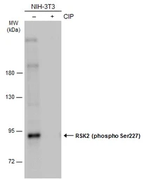 Anti-RSK2 (phospho Ser227) antibody used in Western Blot (WB). GTX133470
