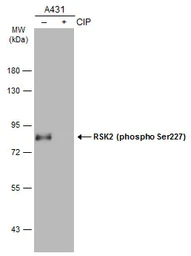 Anti-RSK2 (phospho Ser227) antibody used in Western Blot (WB). GTX133470