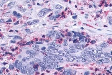 Anti-Leukotriene B4 Receptor 2 antibody used in IHC (Paraffin sections) (IHC-P). GTX13348