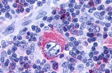 Anti-Leukotriene B4 Receptor 2 antibody used in IHC (Paraffin sections) (IHC-P). GTX13348