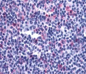 Anti-Leukotriene B4 Receptor 2 antibody used in IHC (Paraffin sections) (IHC-P). GTX13348