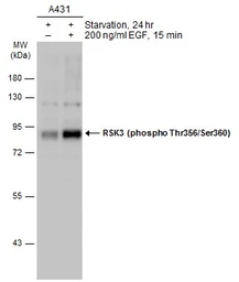 Anti-RSK3 (phospho Thr356/Ser360) antibody used in Western Blot (WB). GTX133480