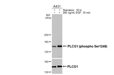 Anti-PLCG1 (phospho Ser1248) antibody used in Western Blot (WB). GTX133530