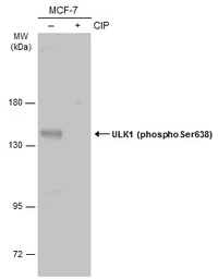 Anti-ULK1 (phospho Ser638) antibody used in Western Blot (WB). GTX133540