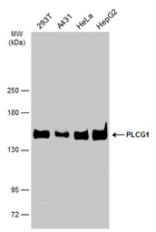 Anti-PLCG1 antibody used in Western Blot (WB). GTX133546