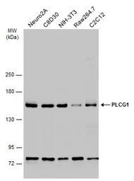 Anti-PLCG1 antibody used in Western Blot (WB). GTX133546
