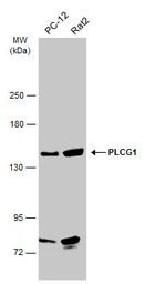 Anti-PLCG1 antibody used in Western Blot (WB). GTX133546