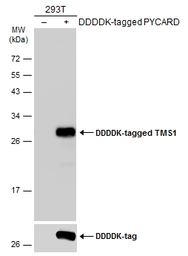 Anti-TMS1 antibody used in Western Blot (WB). GTX133561
