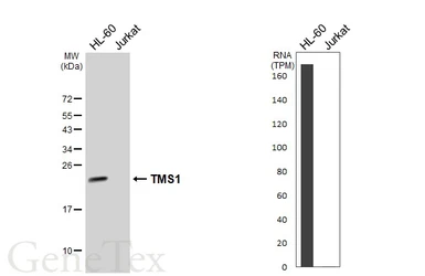 Anti-TMS1 antibody used in Western Blot (WB). GTX133561