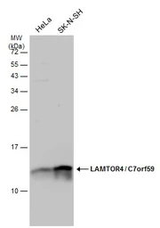 Anti-LAMTOR4 antibody used in Western Blot (WB). GTX133564