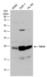 Anti-TMS1 antibody used in Western Blot (WB). GTX133581