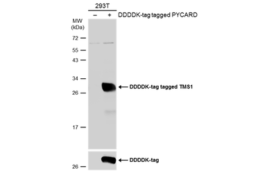 Anti-TMS1 antibody used in Western Blot (WB). GTX133582