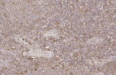 Anti-TMS1 antibody used in IHC (Paraffin sections) (IHC-P). GTX133582