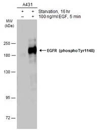 Anti-EGFR (phospho Tyr1148) antibody used in Western Blot (WB). GTX133594
