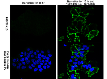 Anti-EGFR (phospho Tyr1148) antibody used in Immunocytochemistry/ Immunofluorescence (ICC/IF). GTX133594