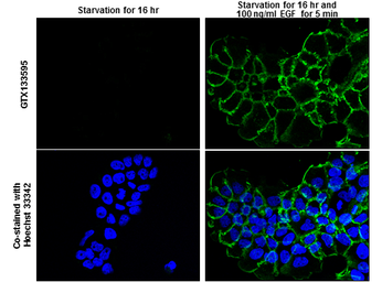 Anti-EGFR (phospho Tyr1173) antibody used in Immunocytochemistry/ Immunofluorescence (ICC/IF). GTX133595