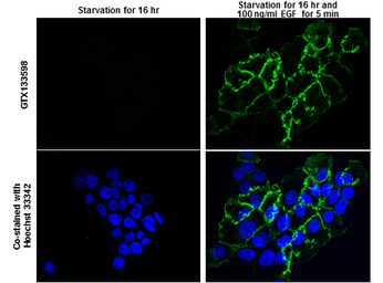 Anti-EGFR (phospho Tyr1045) antibody used in Immunocytochemistry/ Immunofluorescence (ICC/IF). GTX133598