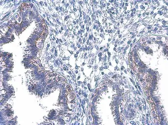 Anti-EGFR (phospho Tyr1045) antibody used in IHC (Paraffin sections) (IHC-P). GTX133598