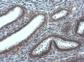 Anti-EGFR (phospho Tyr845) antibody used in IHC (Paraffin sections) (IHC-P). GTX133600