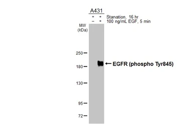 Anti-EGFR (phospho Tyr845) antibody used in Western Blot (WB). GTX133600