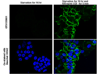 Anti-EGFR (phospho Tyr974) antibody used in Immunocytochemistry/ Immunofluorescence (ICC/IF). GTX133601