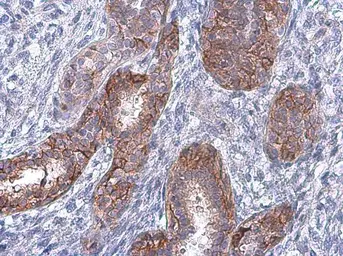 Anti-EGFR (phospho Tyr974) antibody used in IHC (Paraffin sections) (IHC-P). GTX133601