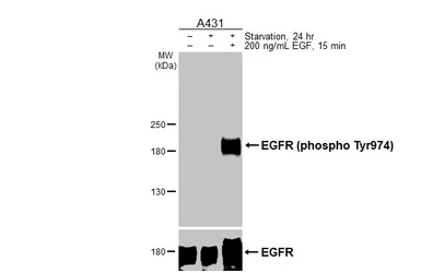 Anti-EGFR (phospho Tyr974) antibody used in Western Blot (WB). GTX133601